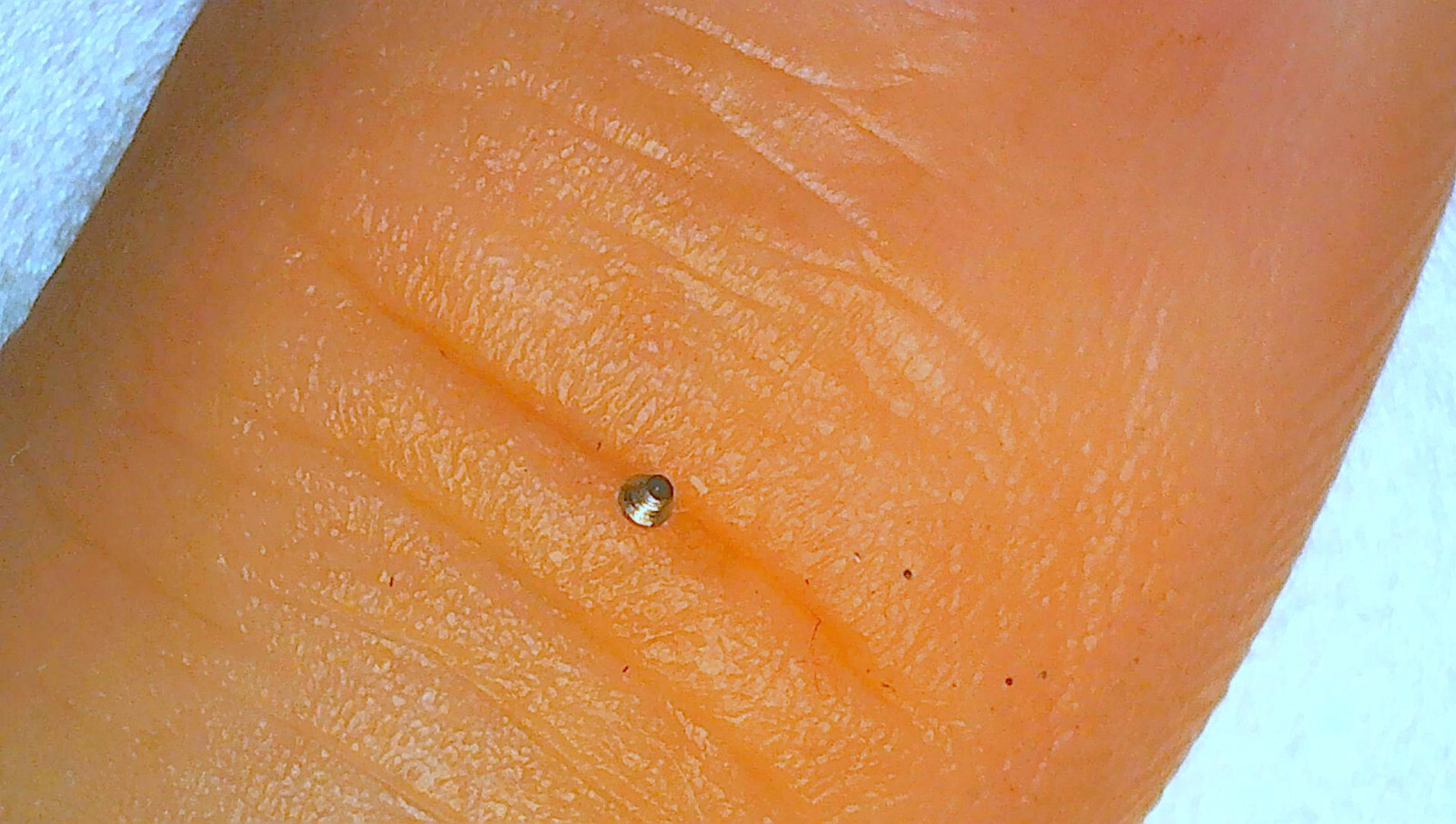 Bidynator Watch Parts